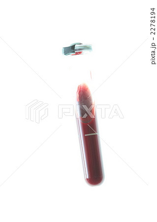 血液 2278194