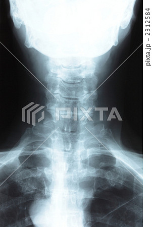 首の骨 2312584