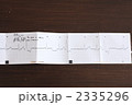 不整脈のある心電図 2335296