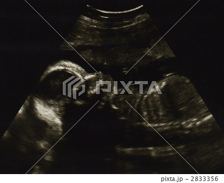エコー写真 胎児 横顔の写真素材