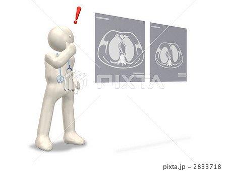 病巣の発見をあらわす3DCGイラスト 2833718
