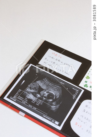 エコー写真のアルバム 妊娠5ヶ月 の写真素材