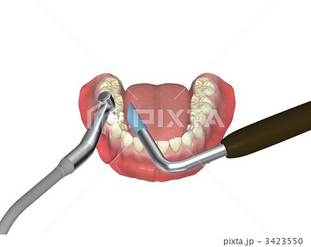 歯科治療 3423550