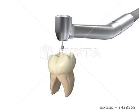 歯科治療 3423558