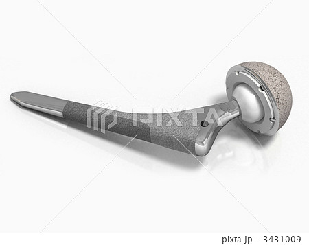 人工関節 人工関節 3431009