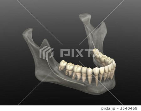 下顎骨 3540469