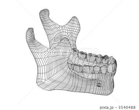 下顎骨 3540488