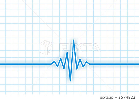 心電図 波形 医療のイラスト素材