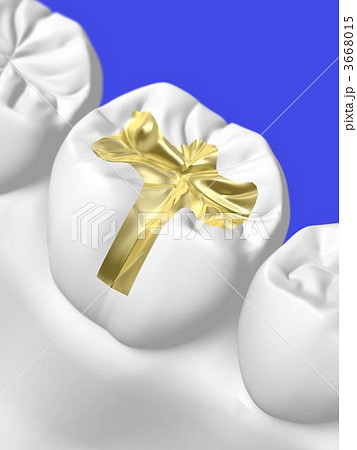 歯科治療 歯科治療 3668015