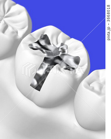 歯科治療 歯科治療 3668018