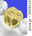 歯科治療 3668019