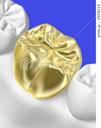 歯科治療 歯科治療 3668019