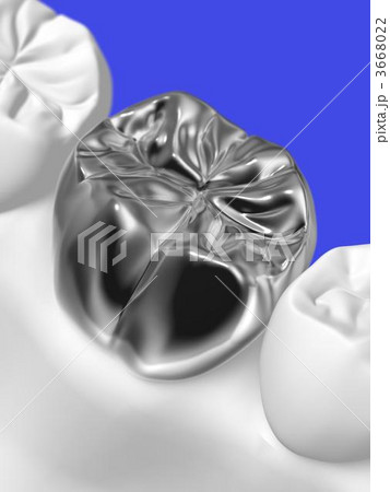 歯科治療 歯科治療 3668022