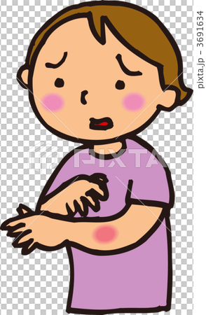 Insect bites Insect bites 3691634