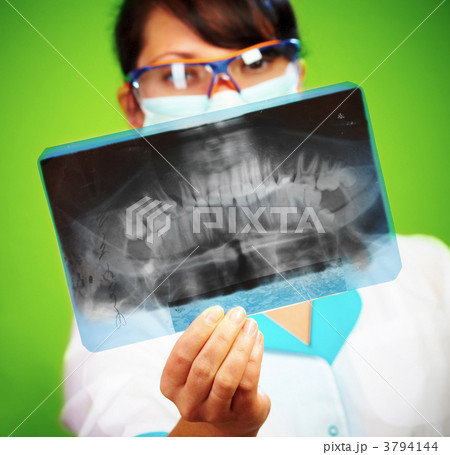 Doctor with xray 3794144