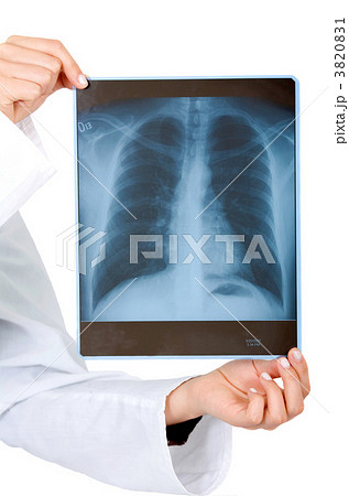 xray over white 3820831