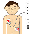 AED　心肺蘇生 3923010