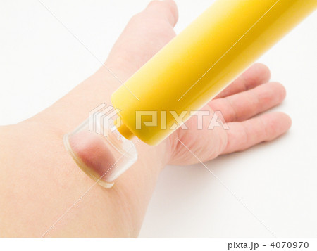 毒吸引器 4070970