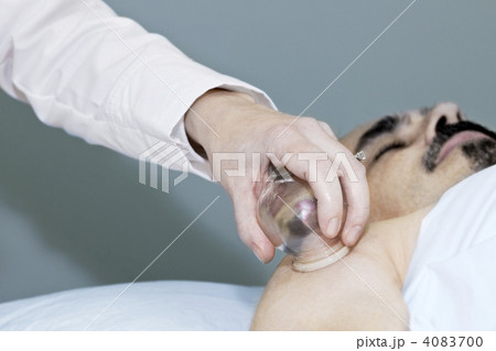 Cupping therapy in traditional chinese medicine 4083700