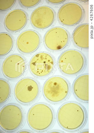 実際の微生物培養 実際の微生物培養 4267606