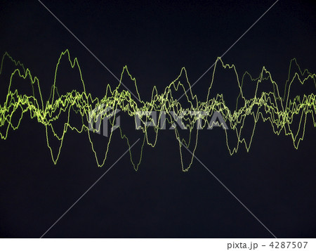 Texture-sinus Texture-sinus 4287507