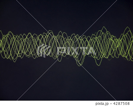 Texture-sinus Texture-sinus 4287508