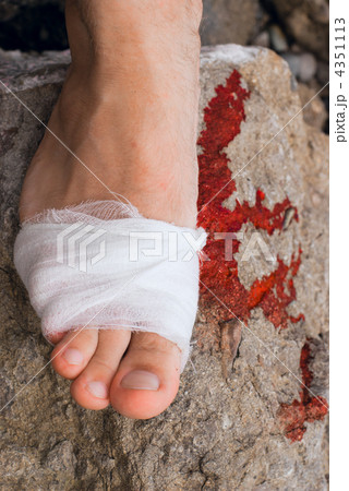 Medicine bandage on human injury foot after accident and blood o 4351113