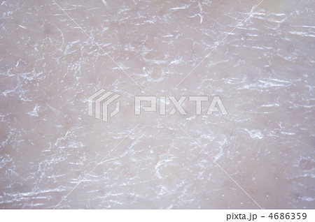 乾燥肌　汚れ肌　シミ肌　顕微鏡写真 4686359