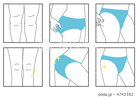 エステ下半身A-8 4742562