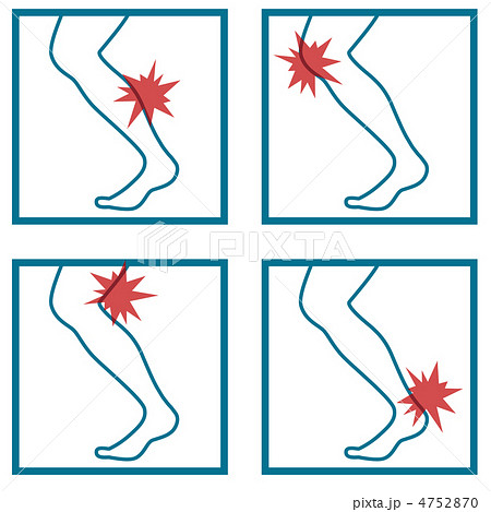 脚怪我A-2 4752870