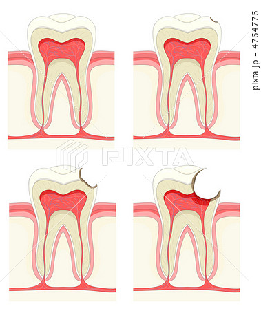 Tooth 4764776