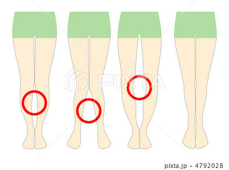 O脚-17 O脚-17 4792028