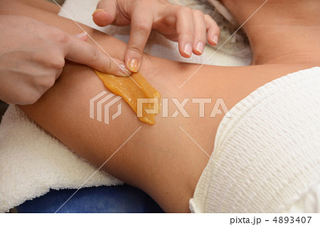 sugaring epilation sugaring epilation 4893407
