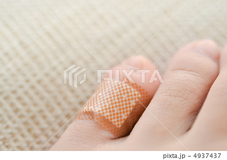 小指の怪我 4937437