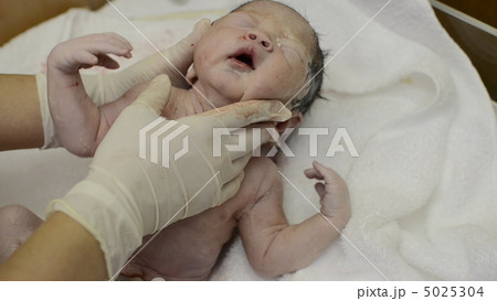 出生後の簡易チェック 出生後の簡易チェック 5025304