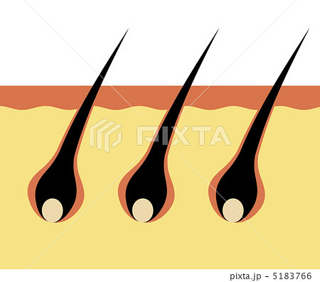 毛根の断面図 5183766