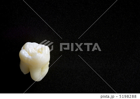 歯 5198288