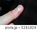 30代男性のイボ 5281829