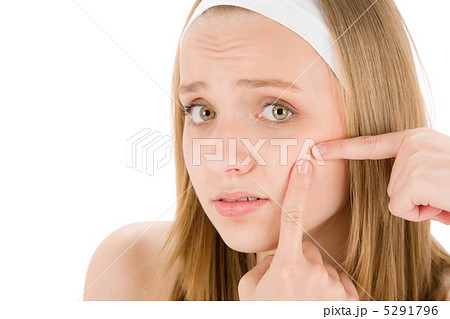 Acne facial care teenager woman squeezing pimple 5291796
