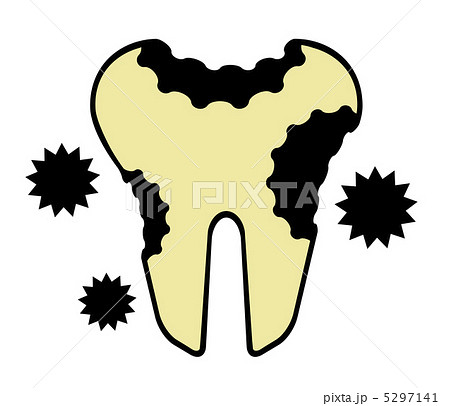 虫歯 5297141