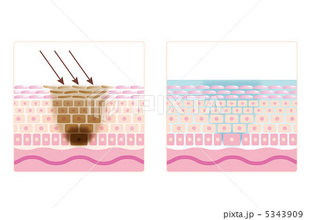 スキンケア 6 美白 しみ 肌 皮膚 断面図 説明なしのイラスト素材