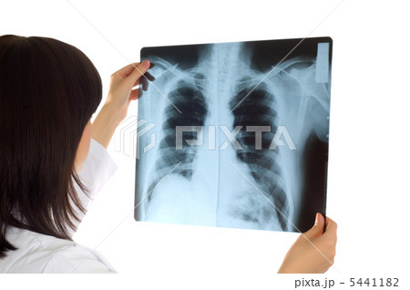 Female doctor looking at x-ray image on white 5441182