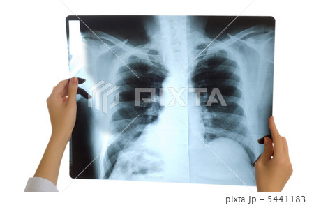 Doctor looking at x-ray image on white 5441183