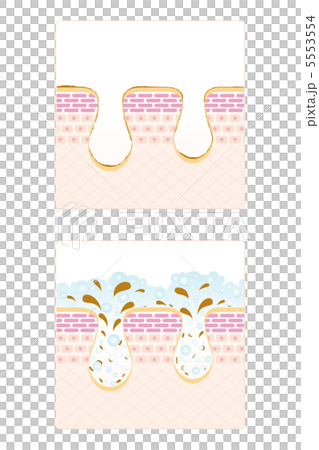 皮膚護理-11■毛孔·面部清潔·皮膚·皮膚·剖面圖·垂直 5553554