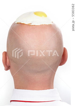 5583362