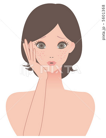 女性 / 顔 / にきび 5601368