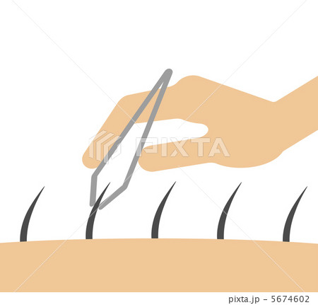 ムダ毛処理 ムダ毛処理 5674602