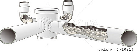 下水管洗浄前 5710814