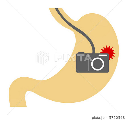 胃の検査 5720548