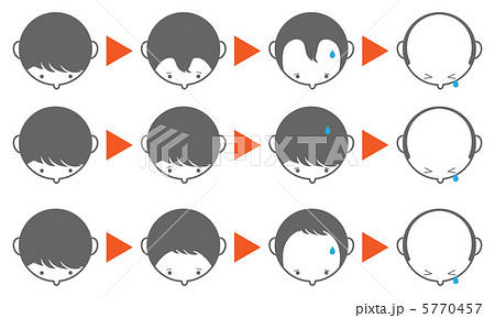 脱毛-4 脱毛-4 5770457